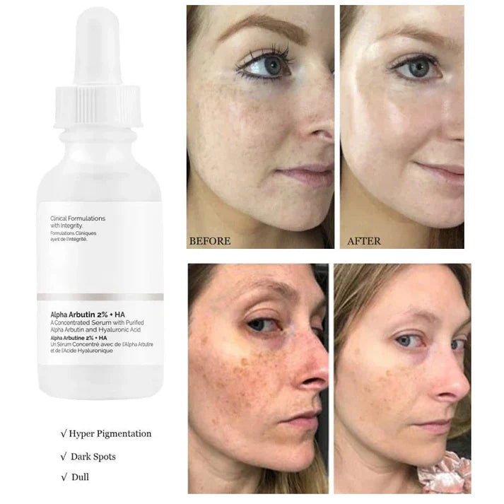 The Ordinary - Azahar Pk 2% + HA Man And Woman